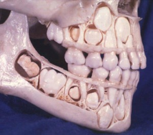 Child's skull before losing baby teeth